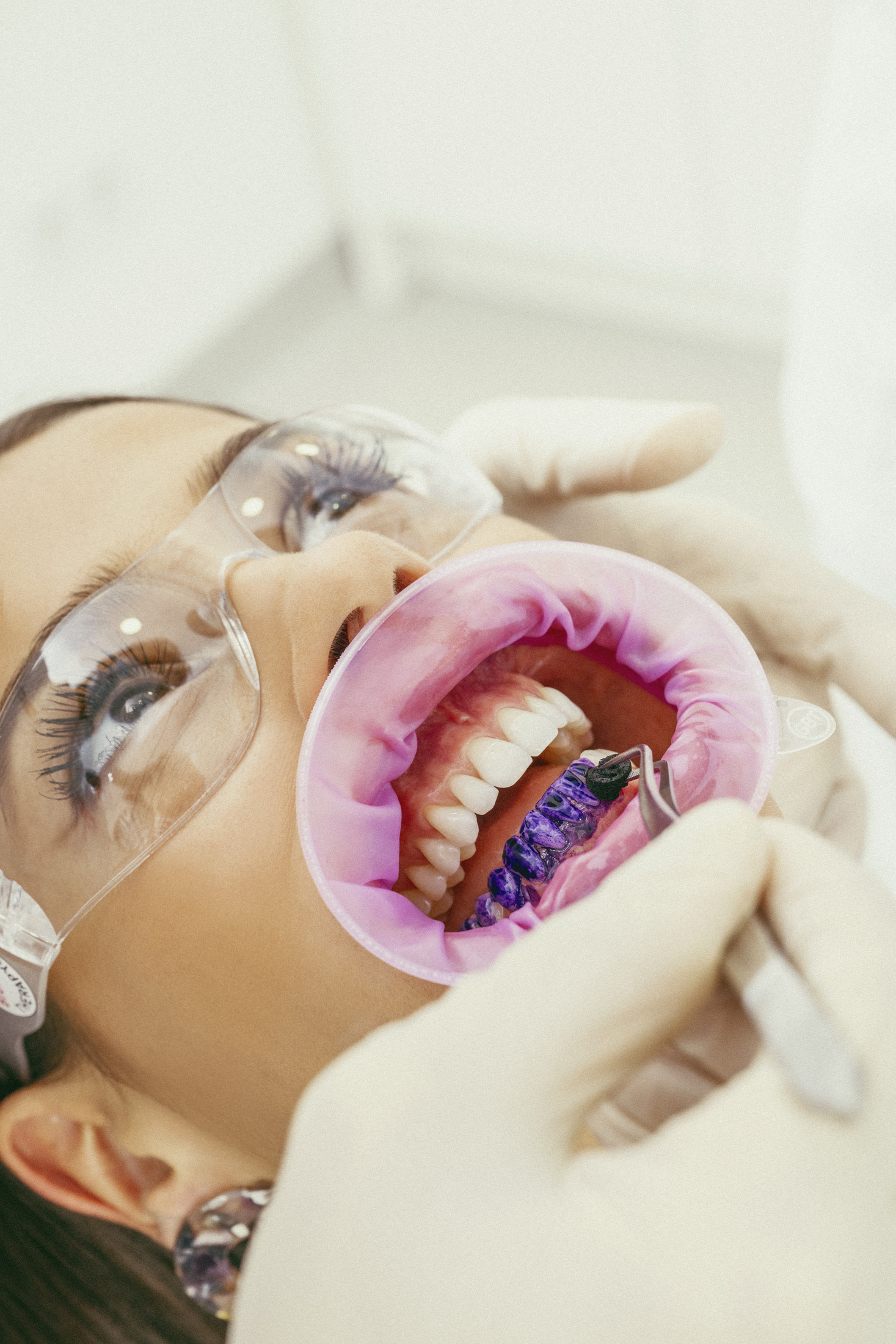 GBT – ein Game Changer für bessere orale Prophylaxe